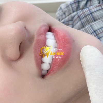 KHÁCH HÀNG TẠI NHA KHOA ÂN ĐỨC