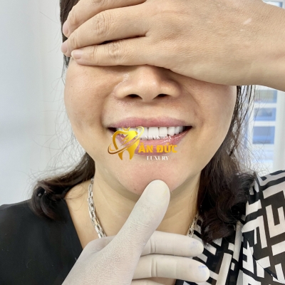 KHÁCH HÀNG TẠI NHA KHOA ÂN ĐỨC