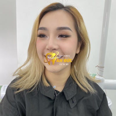 KHÁCH HÀNG TẠI NHA KHOA ÂN ĐỨC