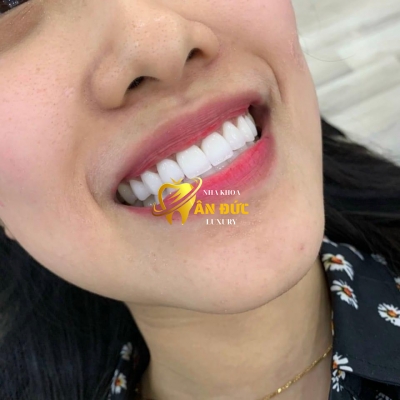 KHÁCH HÀNG TẠI NHA KHOA ÂN ĐỨC